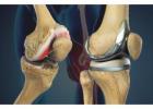 Advanced Orthopedic Treatment in Vaishali Nagar Jaipur